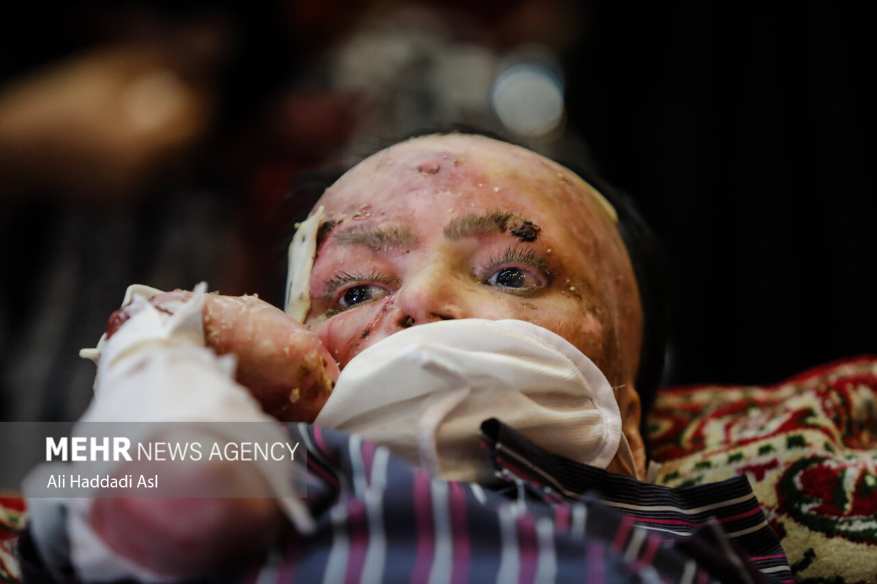 پرونده دعوای حقوقی بیماران پروانه‌ای