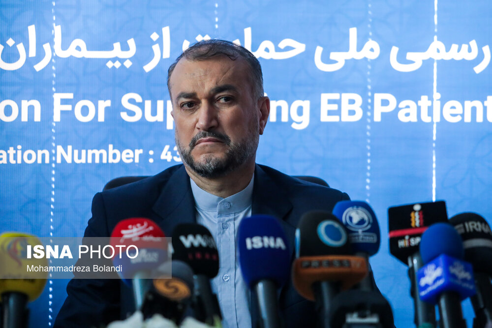 بازدید وزیر خارجه از خانه بیماران پروانه‌ای