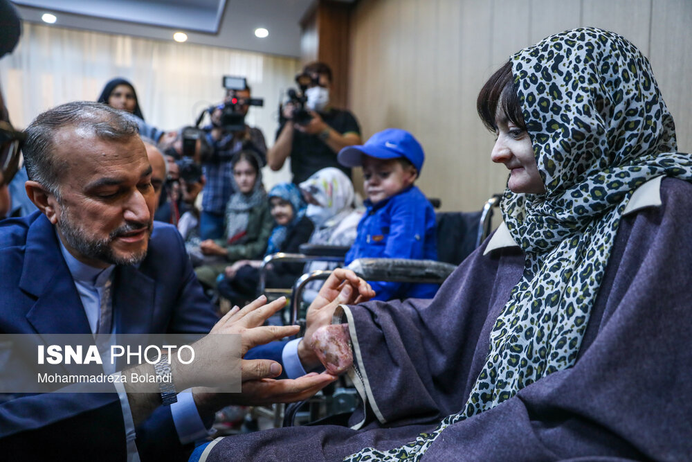 بازدید وزیر خارجه از خانه بیماران پروانه‌ای