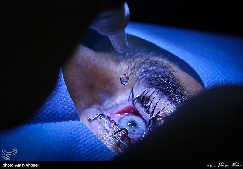 وزیر بهداشت سابق در حال جراحی