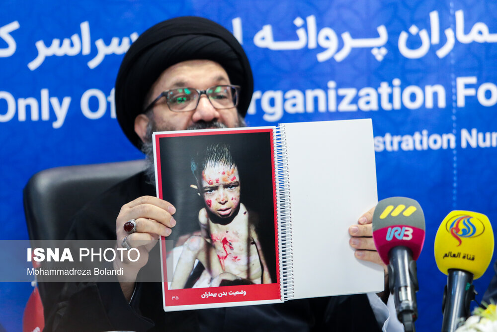 بازدید وزیر خارجه از خانه بیماران پروانه‌ای