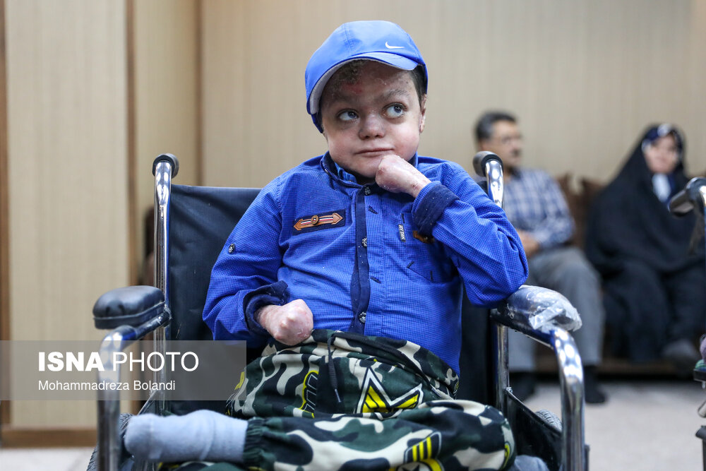 بازدید وزیر خارجه از خانه بیماران پروانه‌ای