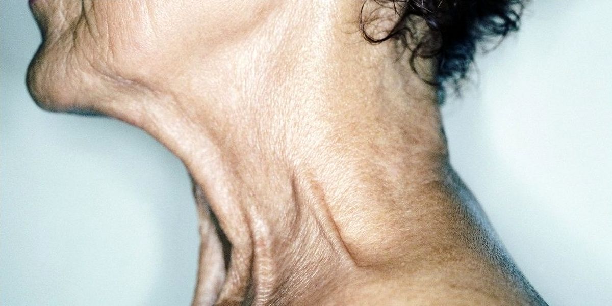 با کمک کرم صورت‌تان، چروک‌های گردن را کاهش دهید