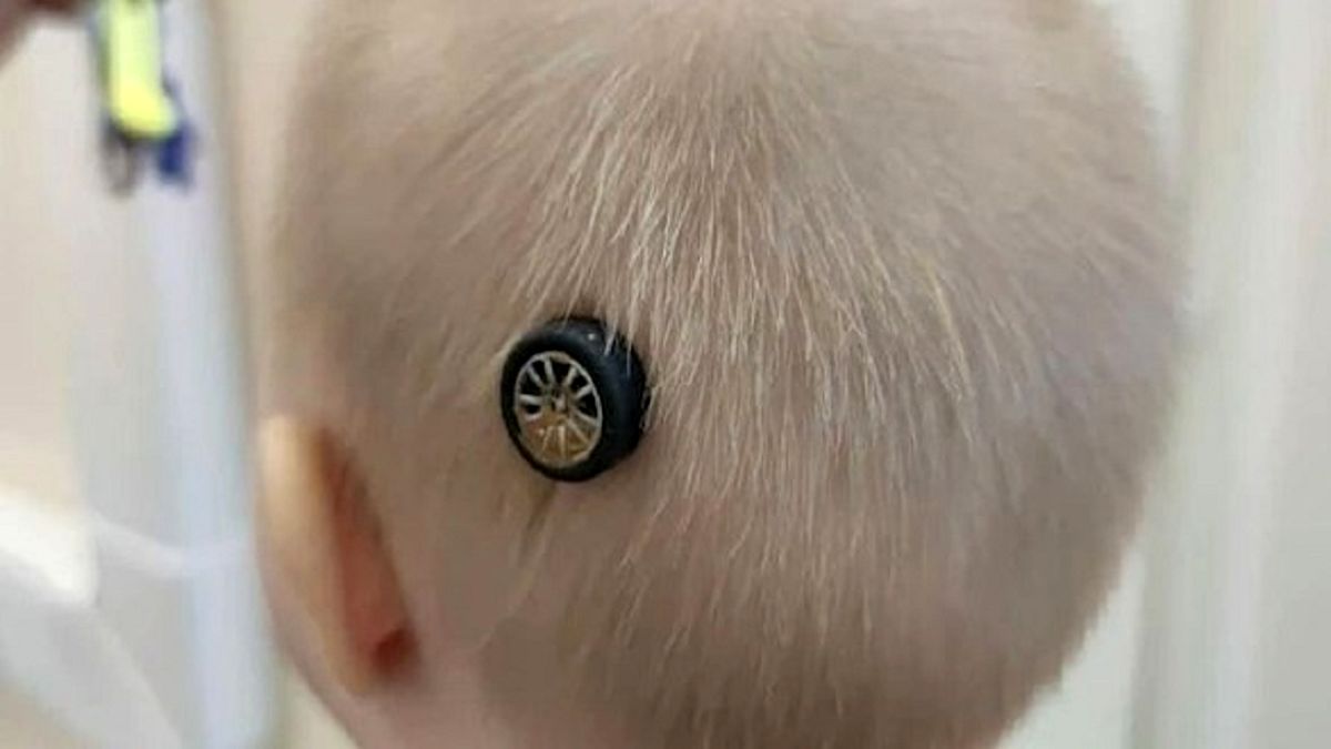 آسیب عجیب کودک با ماشین اسباب بازی +تصاویر