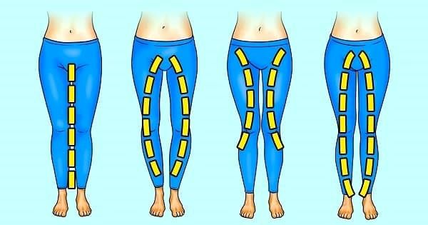 برای پای پرانتزی راه درمان آب درمانی است ؟