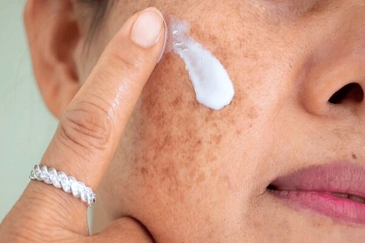 چه اشتباهاتی در تابستان به پوست آسیب میزند؟
