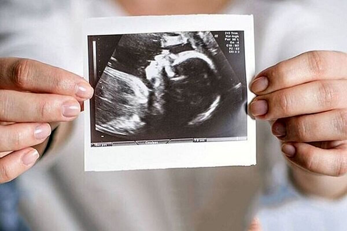 توصیه‌های تابستانی برای مادران باردار