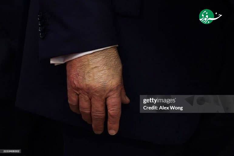عکس وایرال شده از دست راست ترامپ