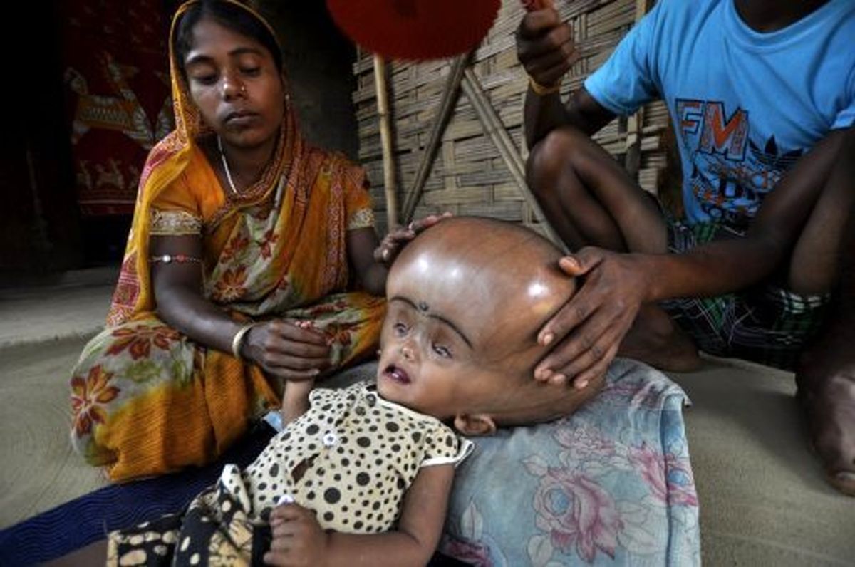 به دنیا آمدن کودک با سر عجیب / عکس