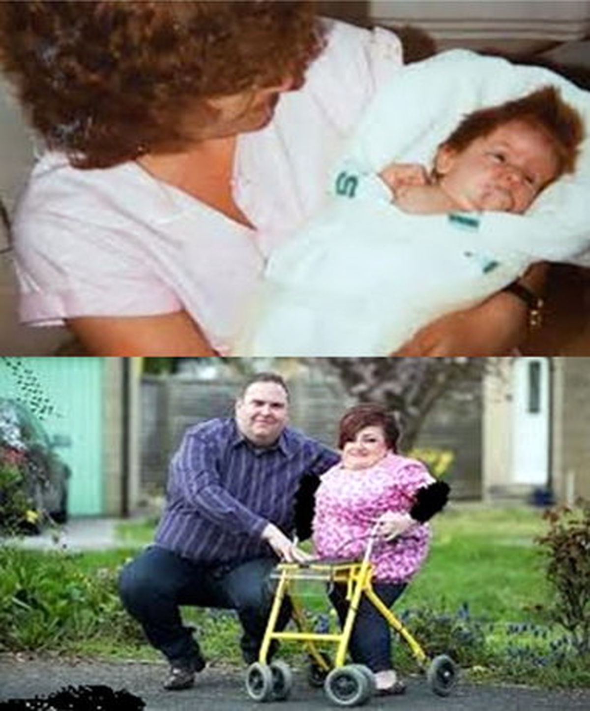 ازدواج، با وجود ابتلا به بیماری نادر/عکس