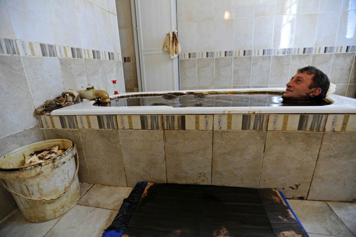 نفت درمانی در آذربایجان/تصاویر