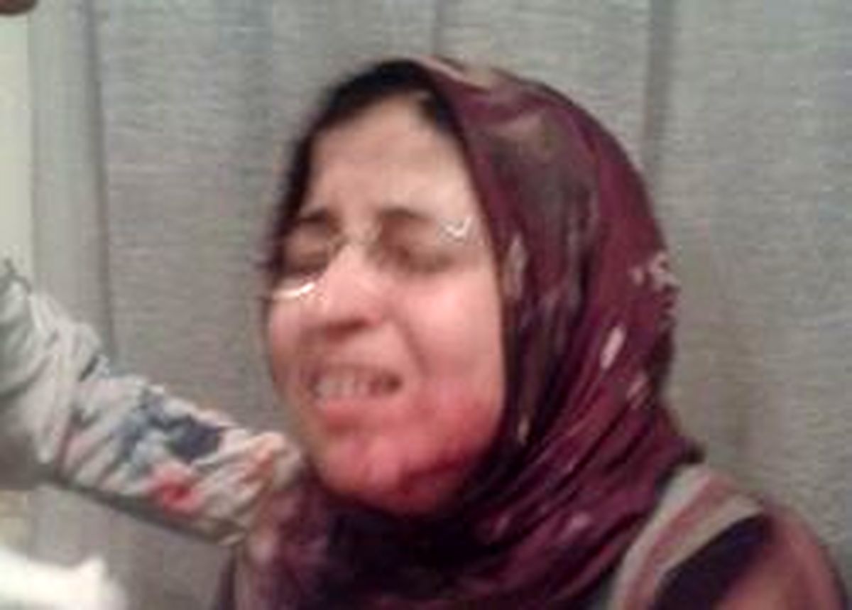 انتقام خونین دانش‌آموز از معلم زن جوان +عکس (+۱۸)