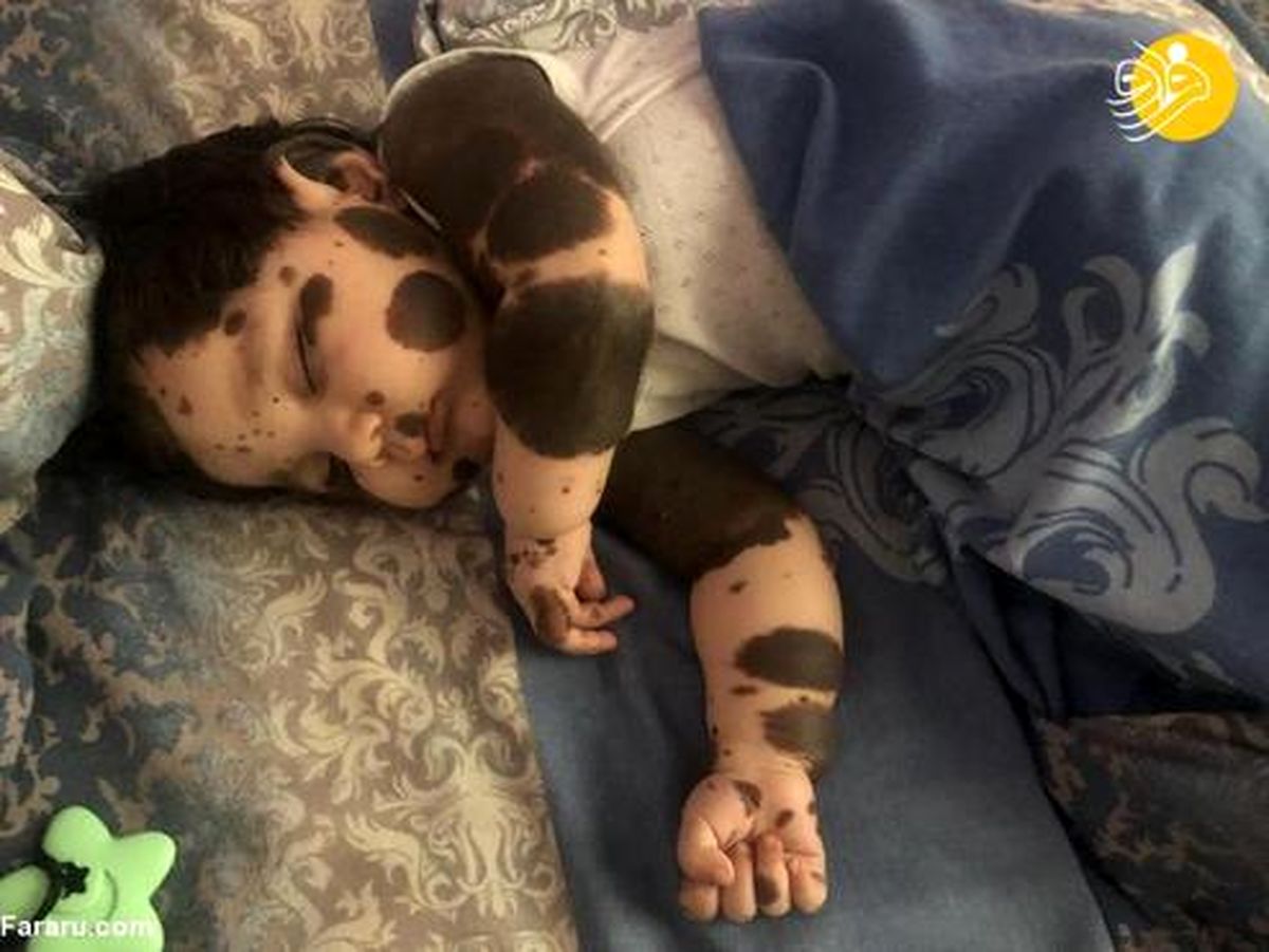 تصاویر: نوزادی شبیه خرس پاندا!