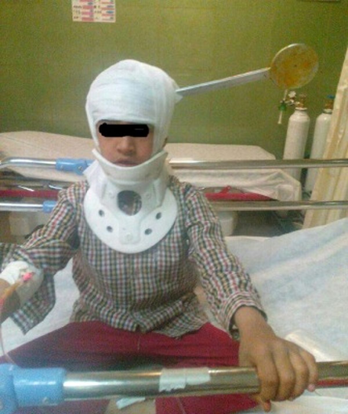 گیرکردن کف گیر در سر کودک +عکس