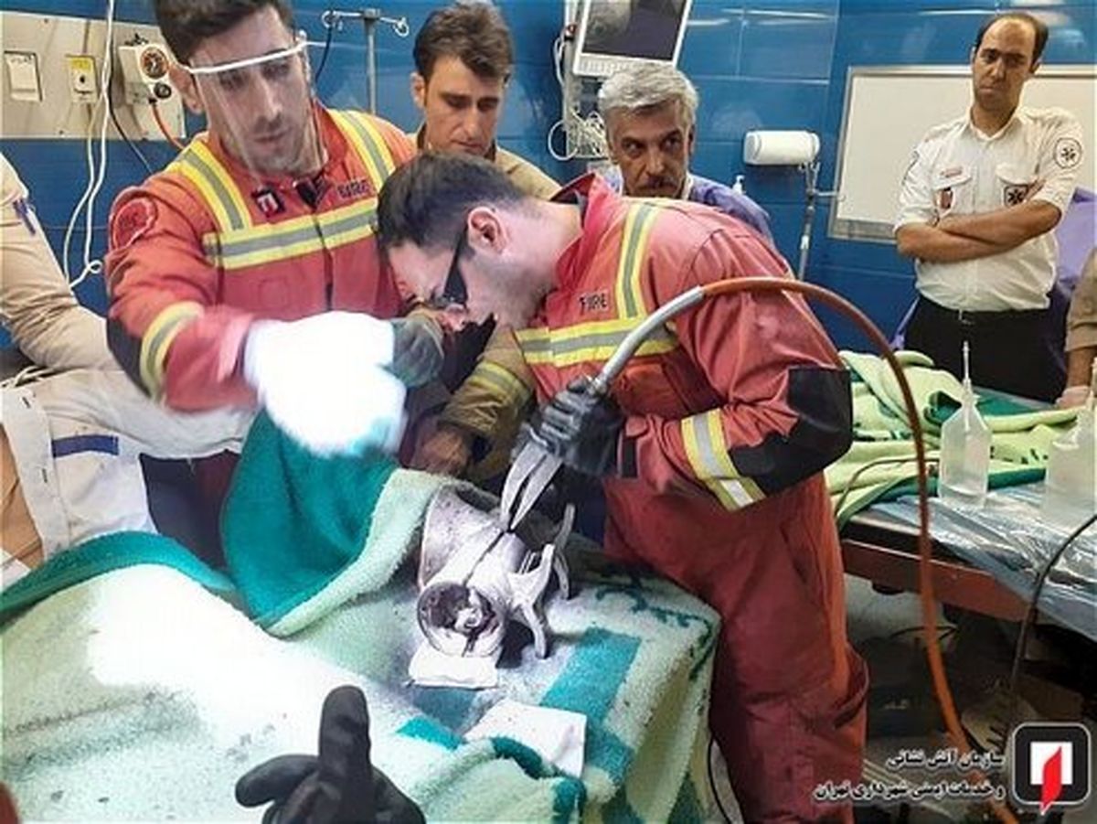 تصاویر: انگشتان دست کارگر ۱۶ ساله رستوران در چرخ‌گوشت