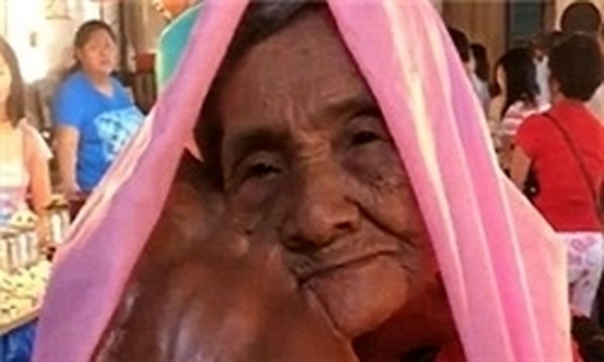 تومور عجیب در صورت زن فیلیپینی +تصاویر