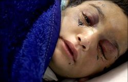 زنگ خطر افزایش میل به کودک آزاری به صدا درآمد