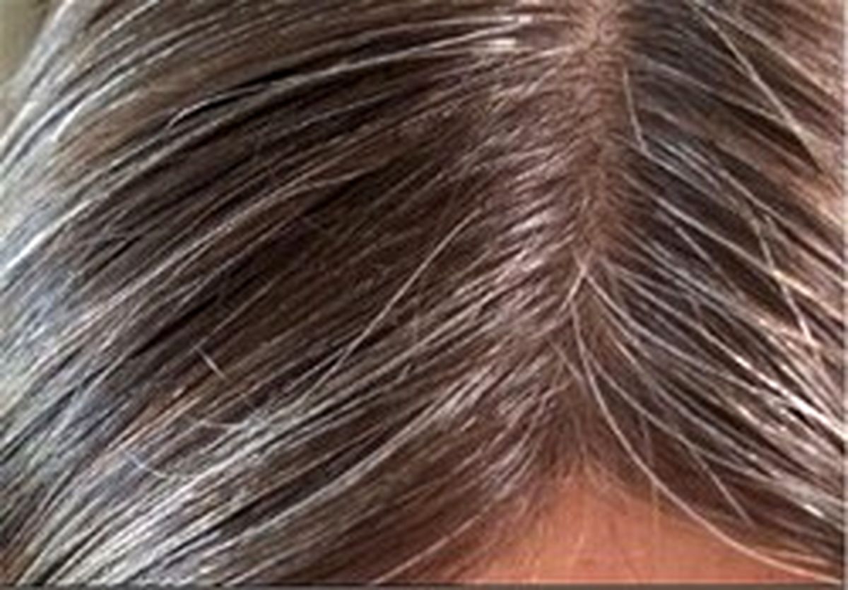 علت سفید شدن زودرس مو‌ها چیست؟