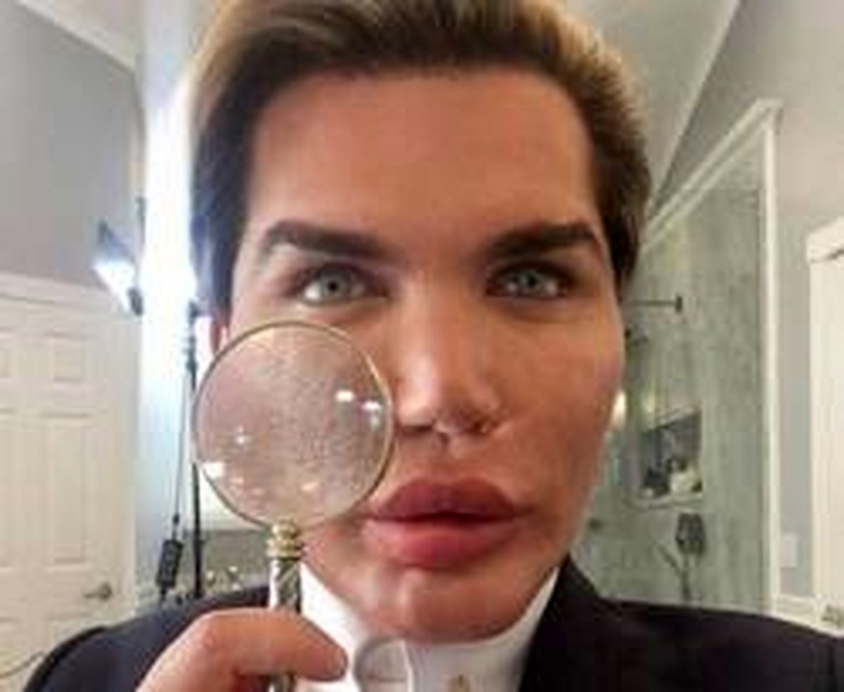 دلایل افزایش عمل زیبایی در بین مردان