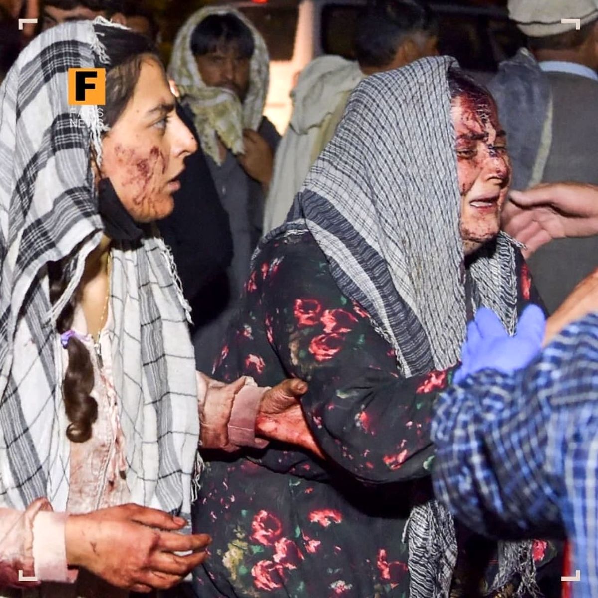 تلفات انفجارهای کابل به ۱۰۳ نفر رسید