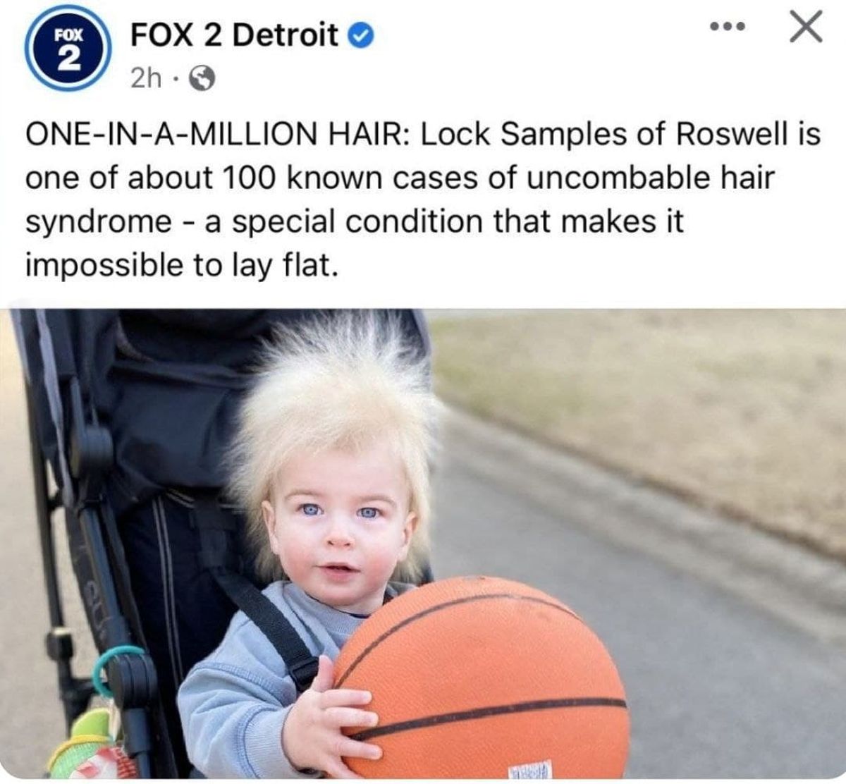 پسری با موهای شانه نشونده +عکس