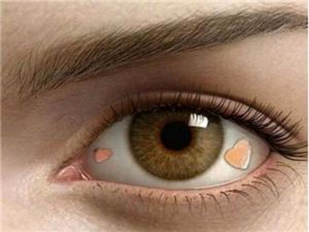 دغدغه میلیونرهای تهرانی؛ کاشت نگین ۷ میلیونی در چشم!