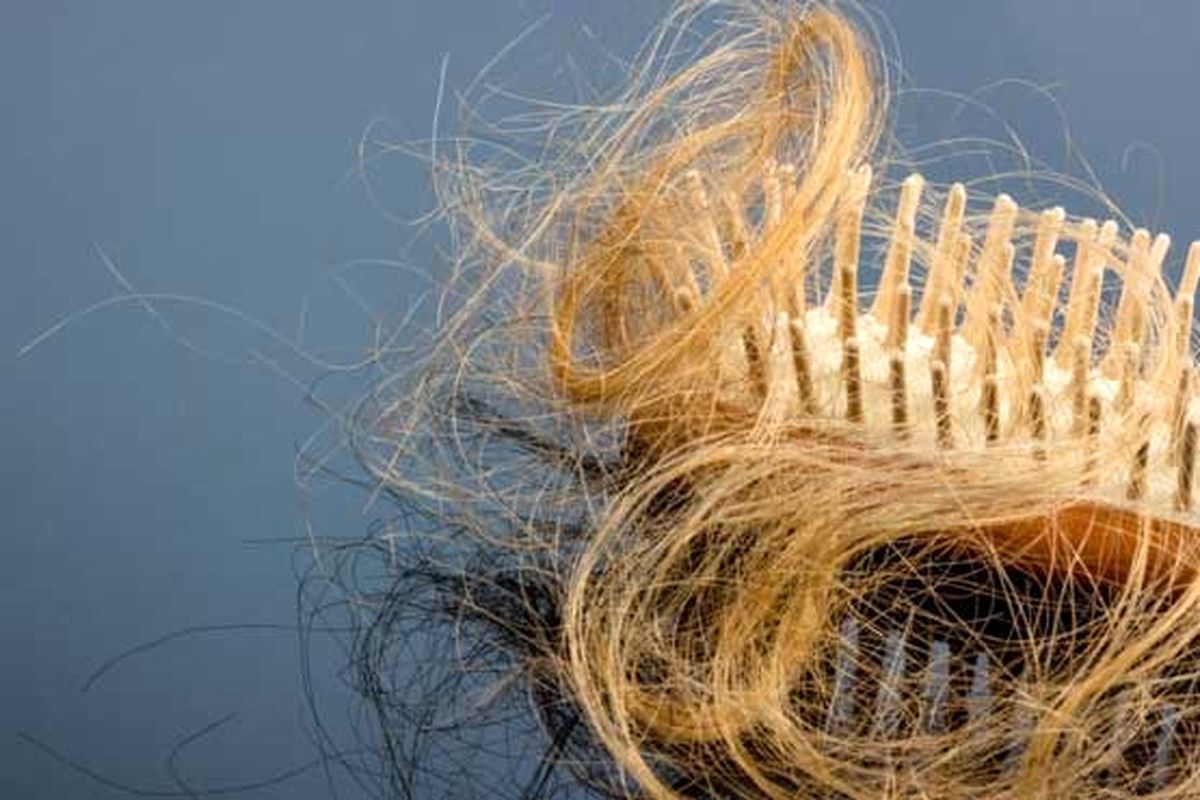 این ۴ خوراکی ریزش موهایتان را در لحظه متوقف می‌کند
