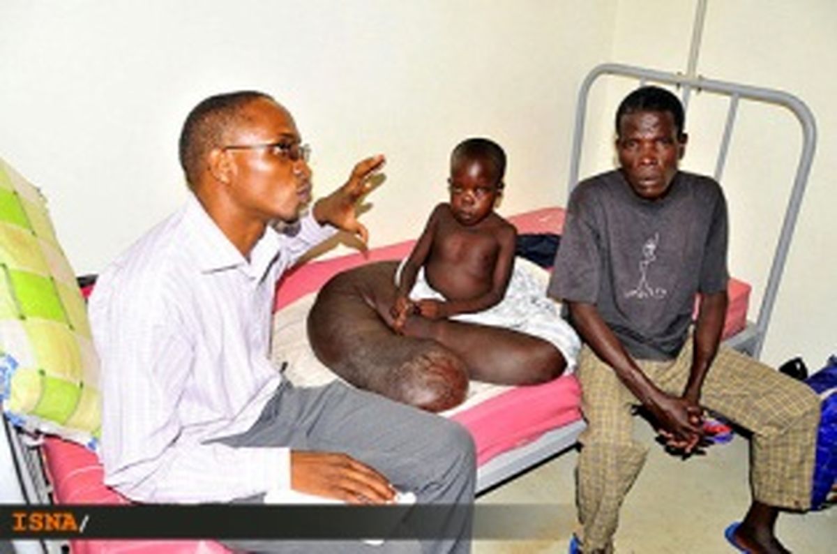 بيماری عجيب پسر اوگاندايي/تصویر