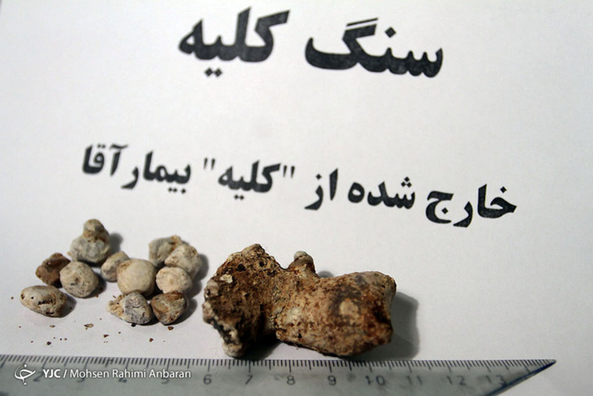 گزارش تصویری: اجسام خارج شده از بدن بیماران