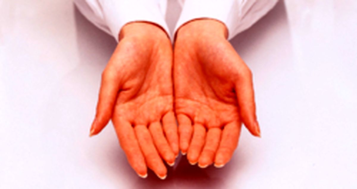 با عرق کردن کف دست و پا خداحافظی کنید