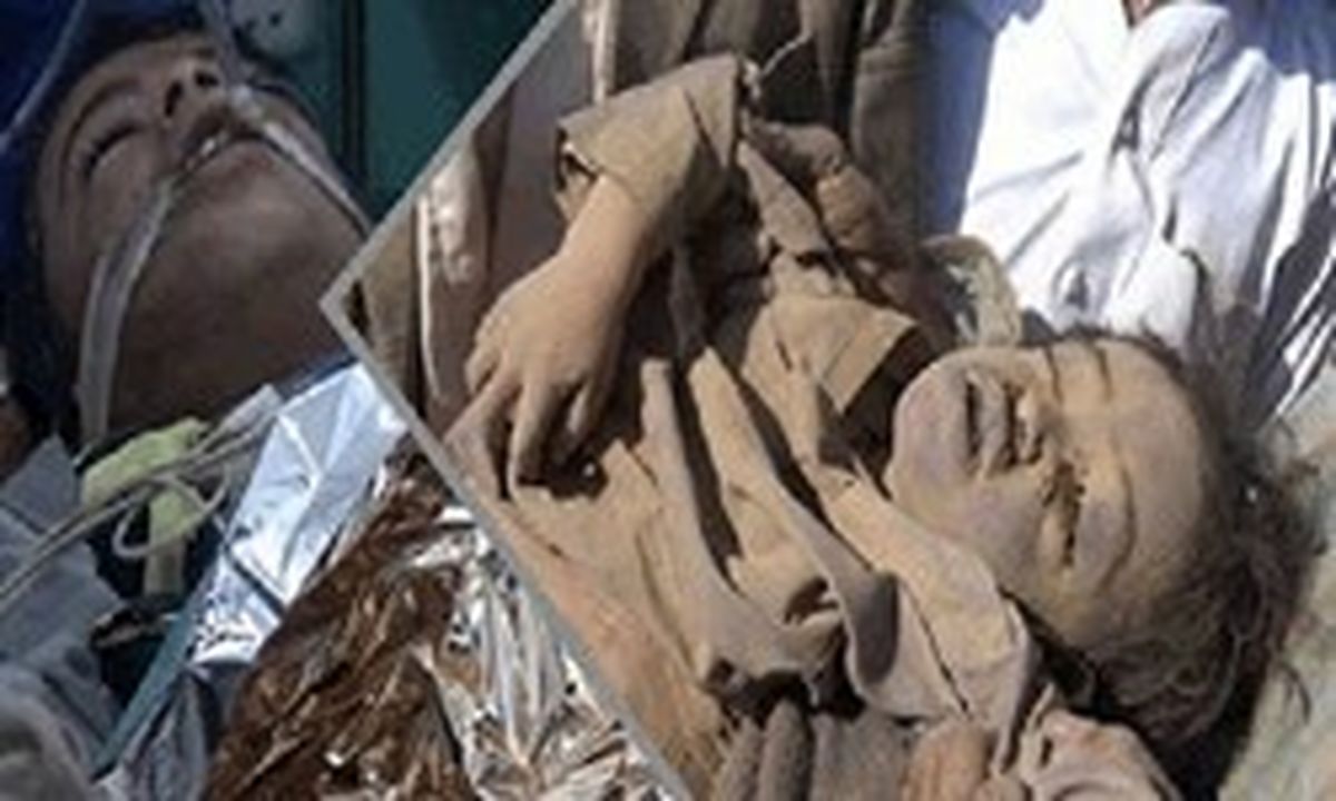 آمار شهدای یمنی از ابتدای حمله ائتلاف سعودی