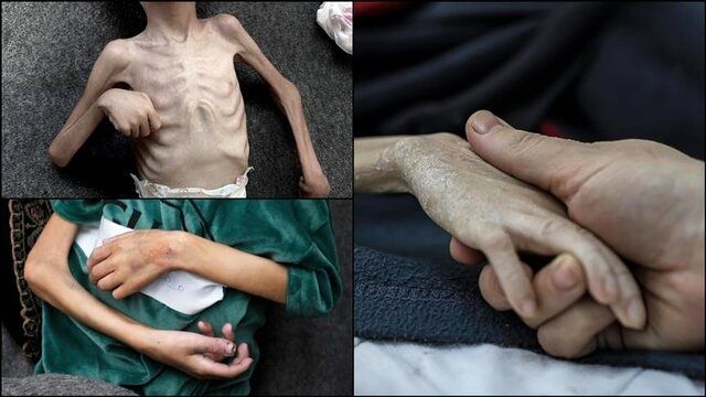 اخبار غزه | شهادت ۶۰ کودک در غزه در ۶۰۰ روز گذشته 