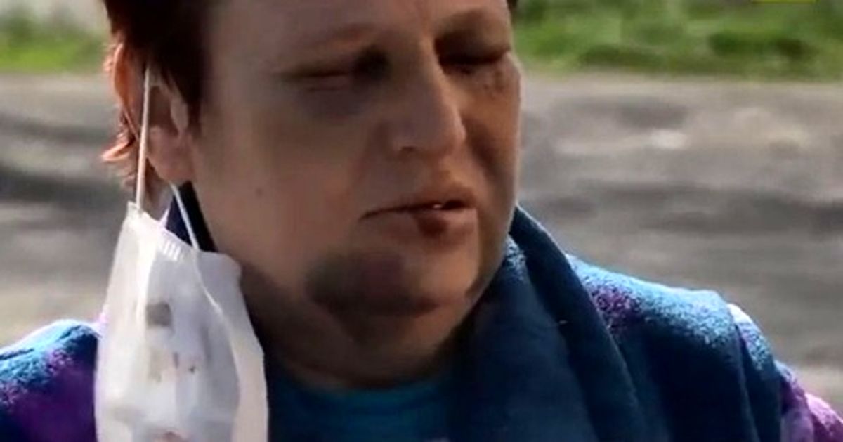 نجات معجزه آسای زن زنده به گور شده! +تصاویر