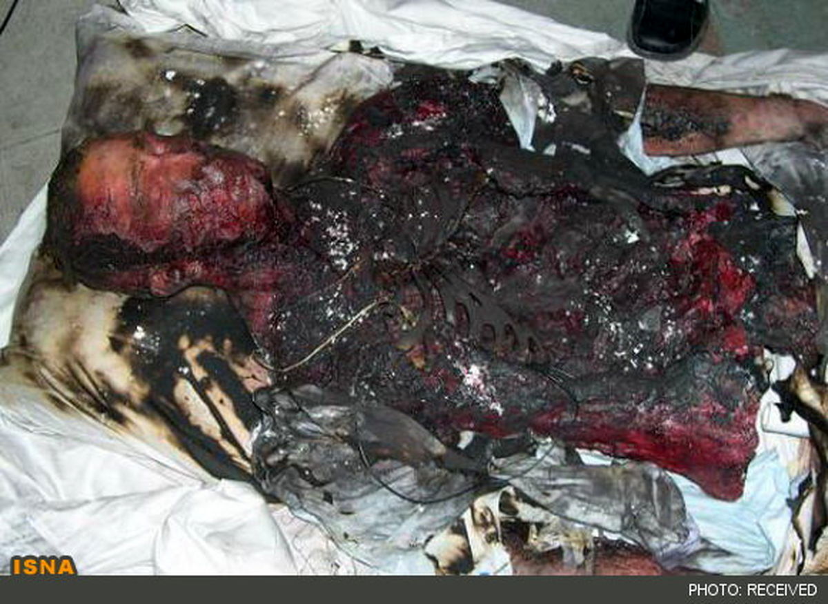 كشف يك جسد سوخته در جاده كرج+عکس