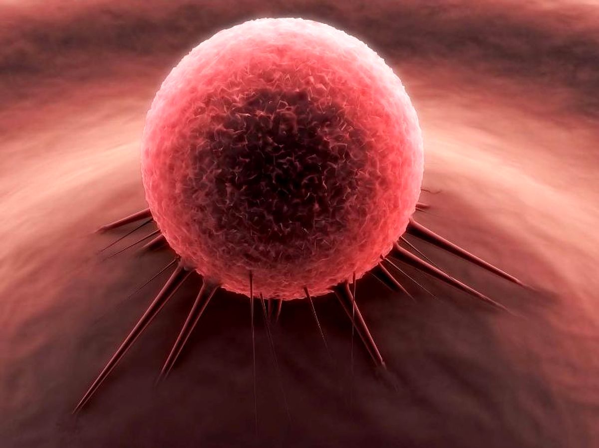 مرگبارترین سرطان به خاطر زیبایی ناخن‌ها