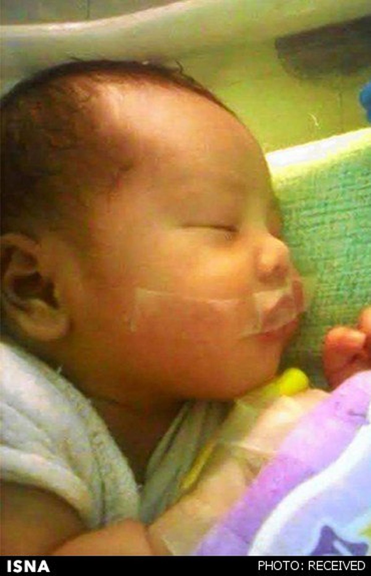 عکسی از بی‌رحمی یک پرستار