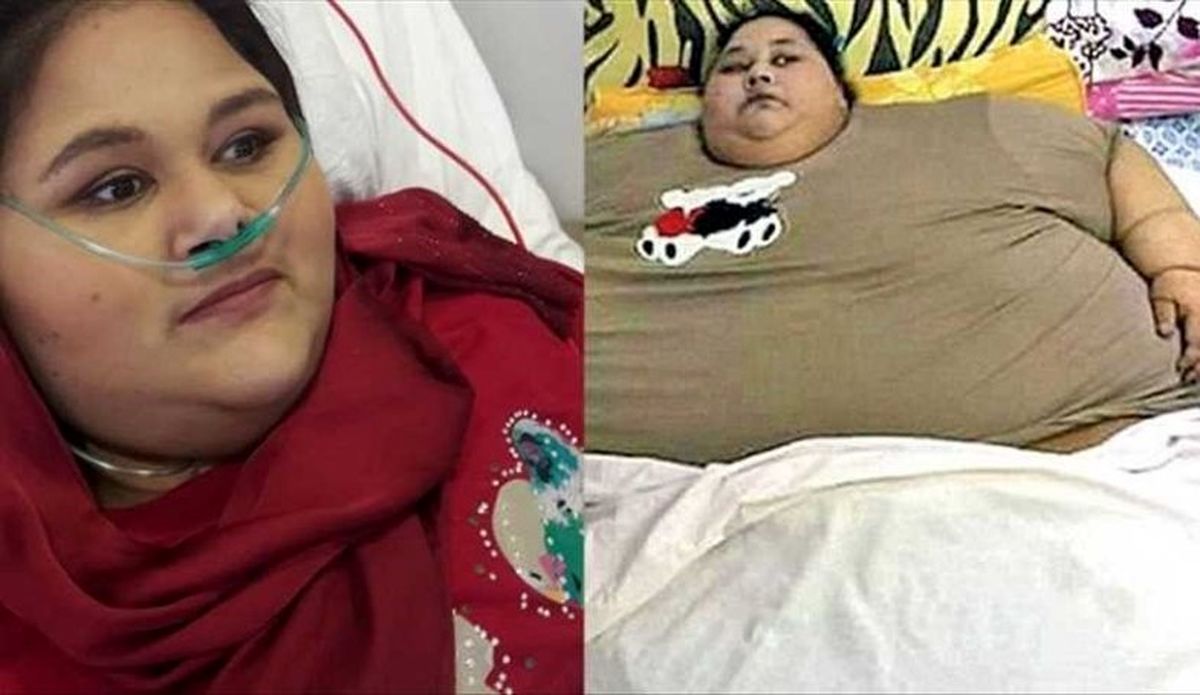 نتیجه تلاش چاق ترین دختر جهان برای لاغری +تصاویر
