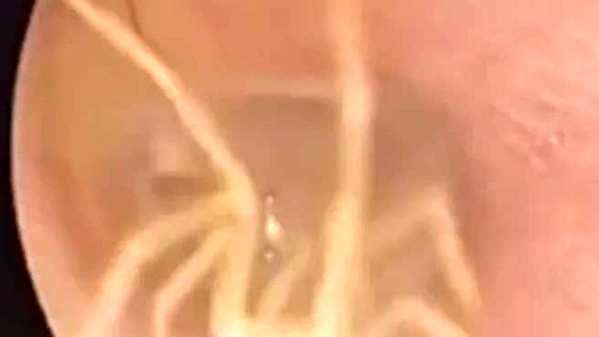 علت عجیب گوش درد زن بیمار فاش شد+ تصاویر وحشتناک