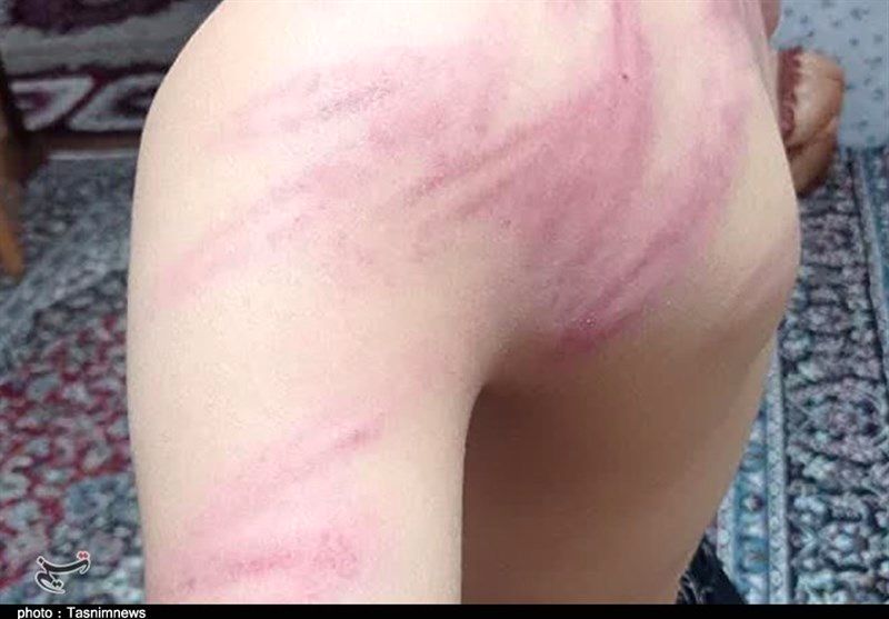 تنبیه بدنی دانش‌آموزان توسط معلم در سنندج | معلم اخراج شد