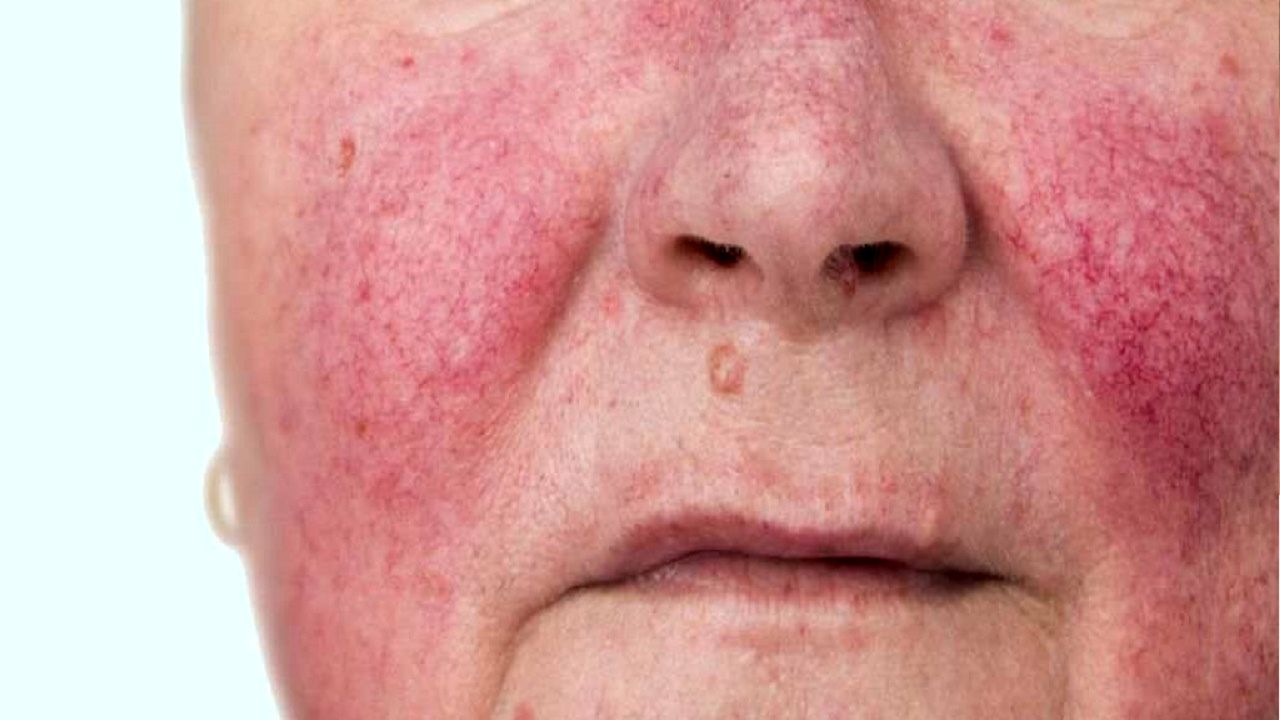 سرنخ‌های برخی بیماری ها در صورت 