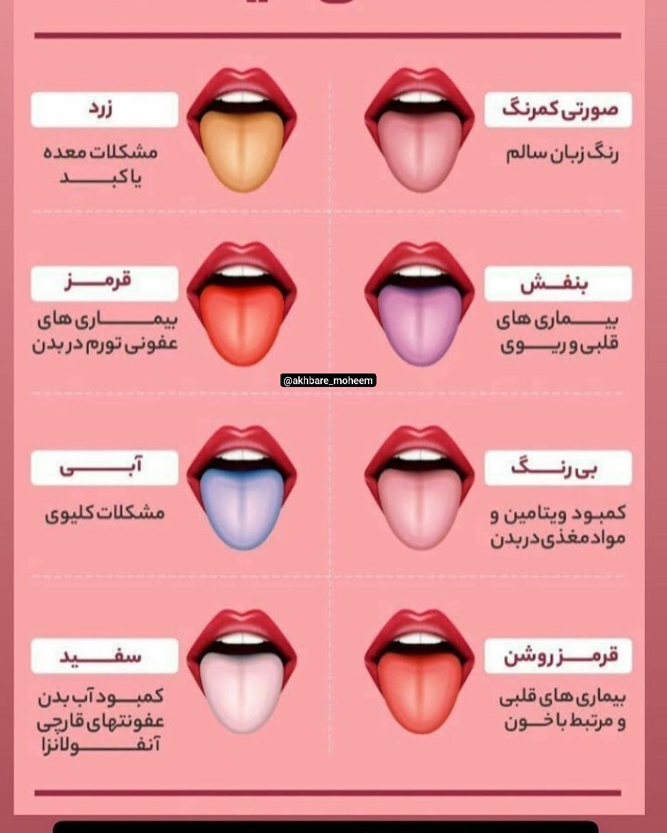 رنگ زبان چه علائمی در بدن را نشان میدهد؟