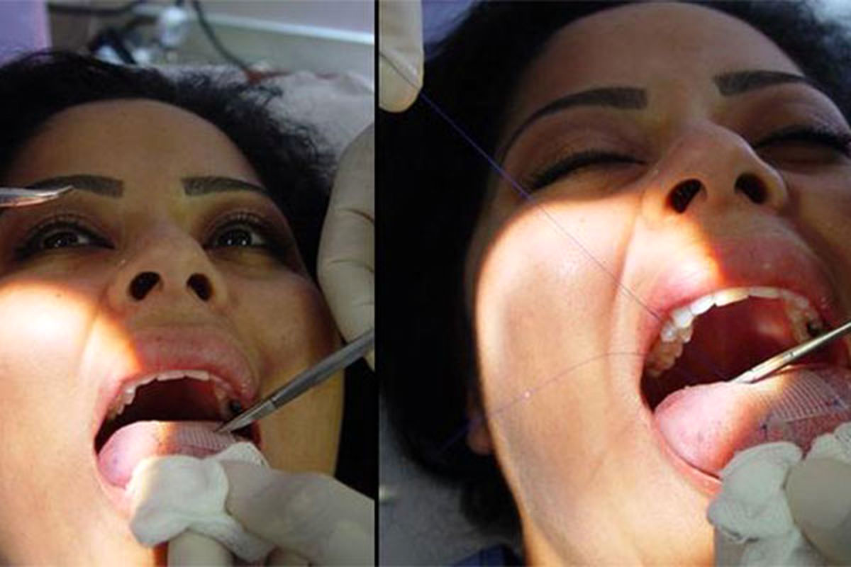 روشی عجیب‌ و‌ زجرآور‌ برای لاغری!/ عکس