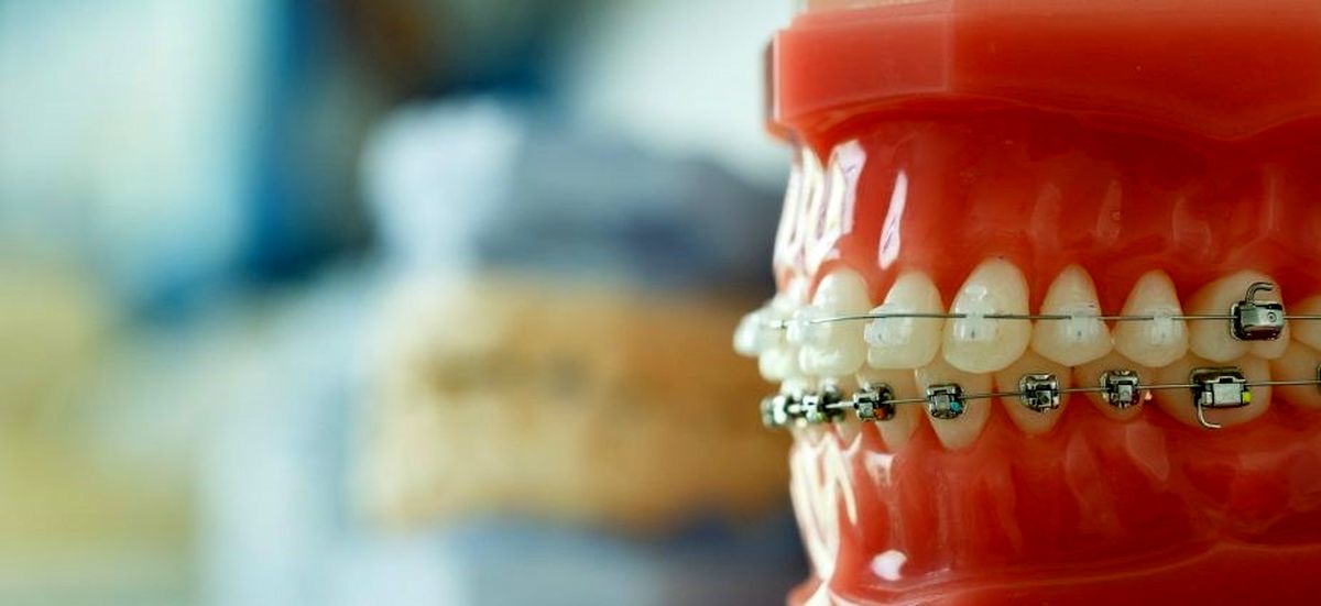 چرا ارتودنسی می کنیم؟