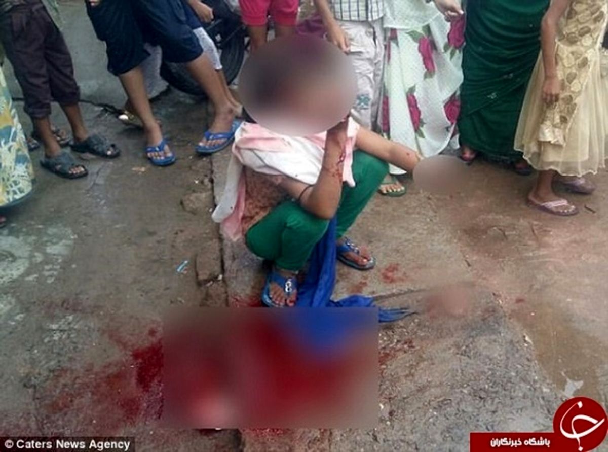 قطع دست دختر ۱۵ ساله به خاطر تلفن همراه +تصاویر