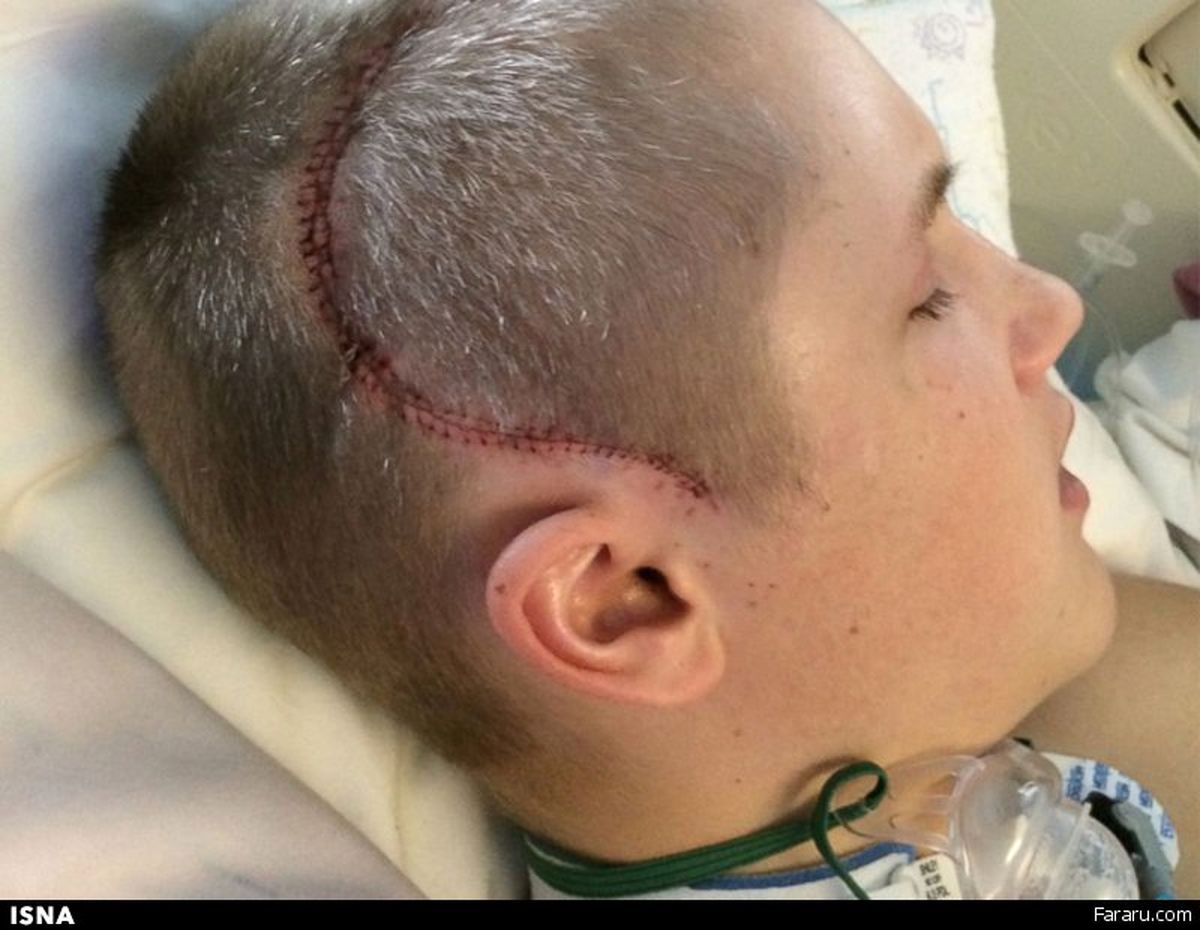 نوجوانی که «معجزه» را تجربه کرد/تصاویر