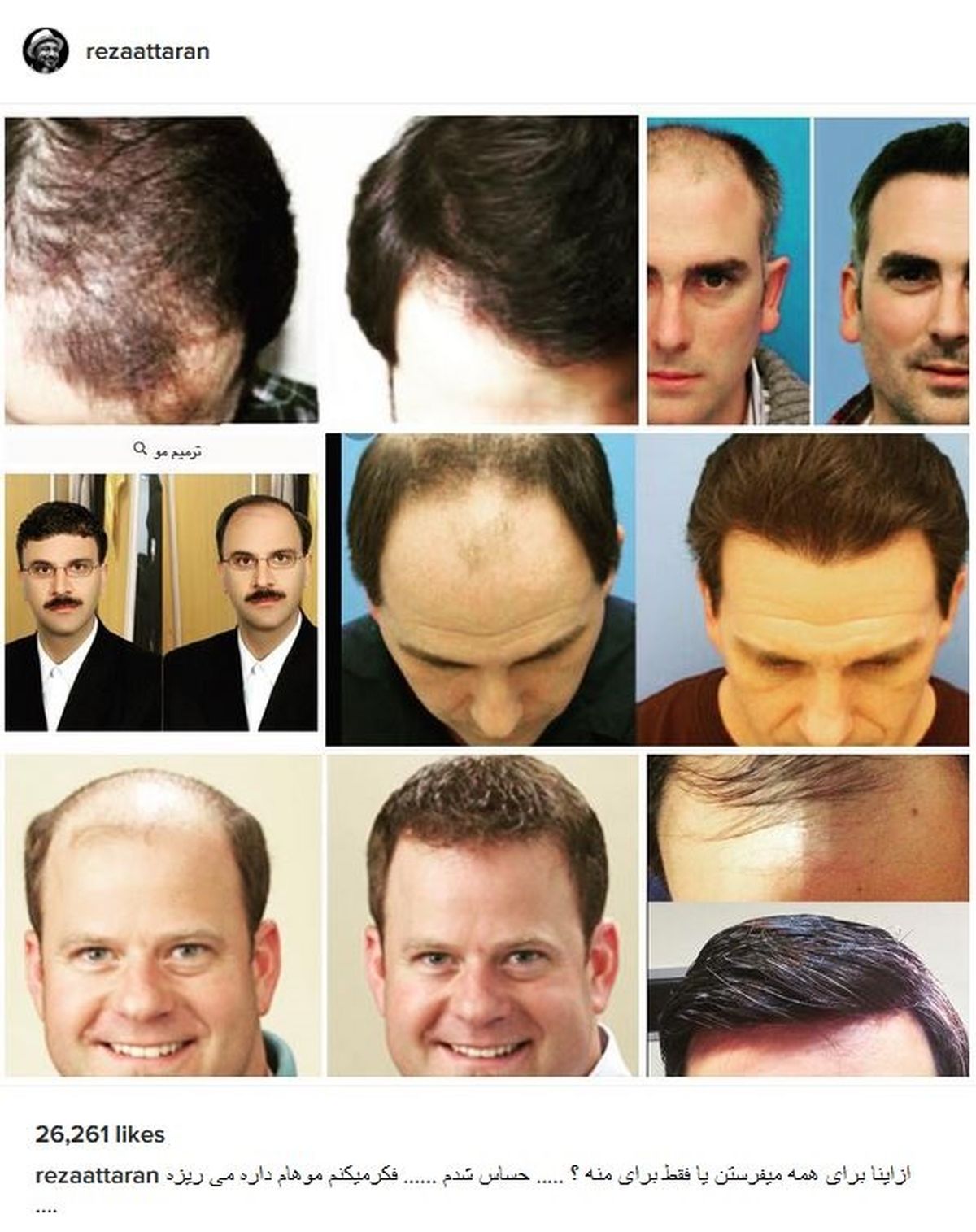 تبلیغی که رضا عطاران را حساس کرد +عکس