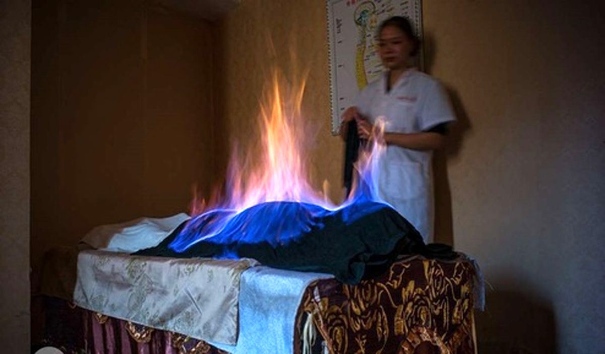 تصویری عجیب از جلسه آتش‌درمانی در چین! +عکس