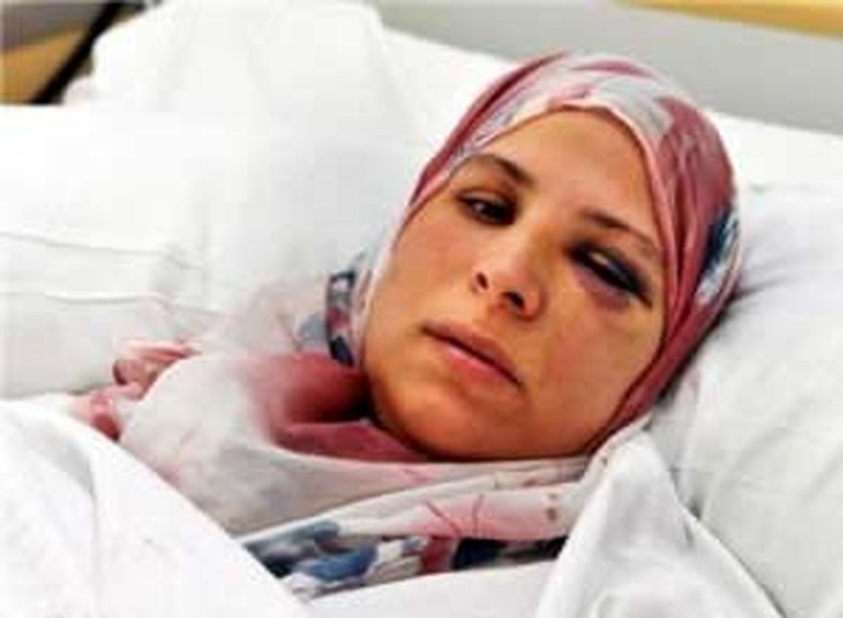 حمله به زنی محجبه در حومه پاریس/عکس