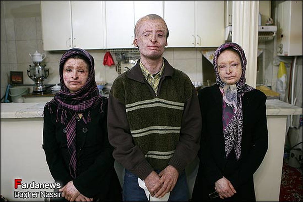 چشم نیمه باز شهرام هنوز نیازمند قدم های بلندتر