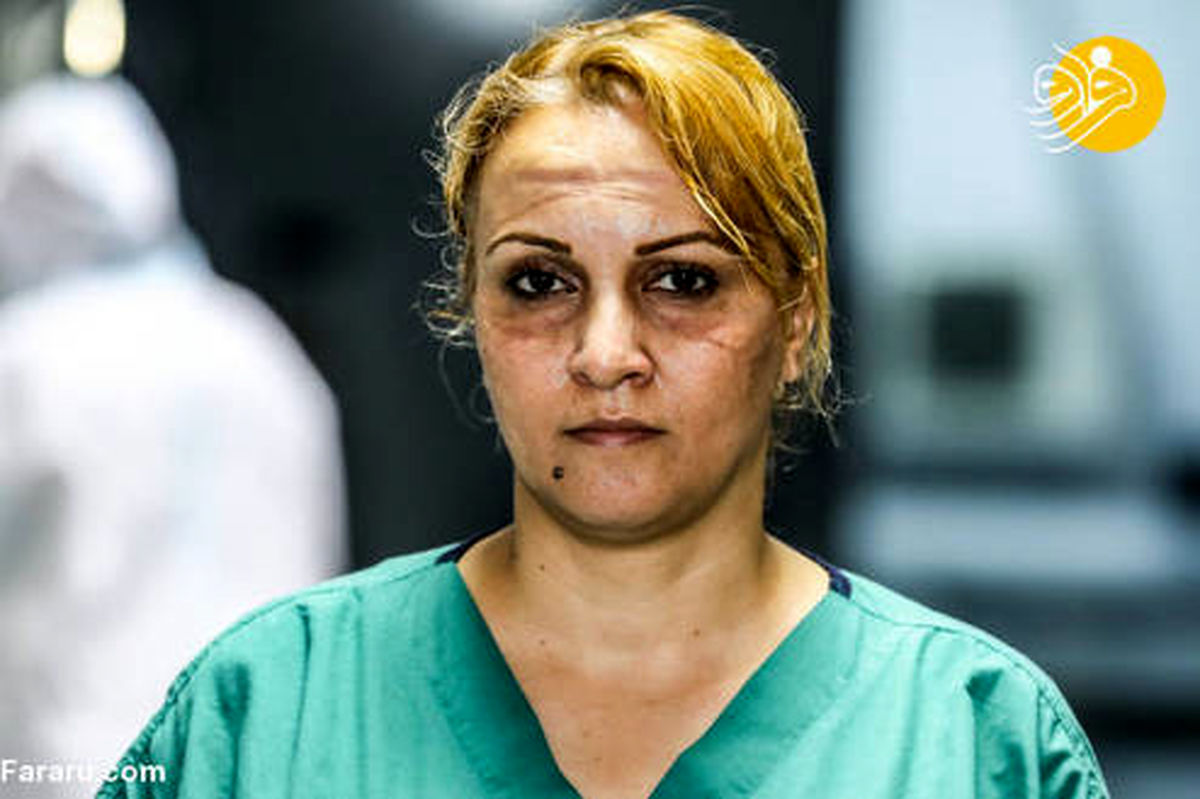 تصاویر: اثر ماسک بر چهره پرستاران آذربایجانی